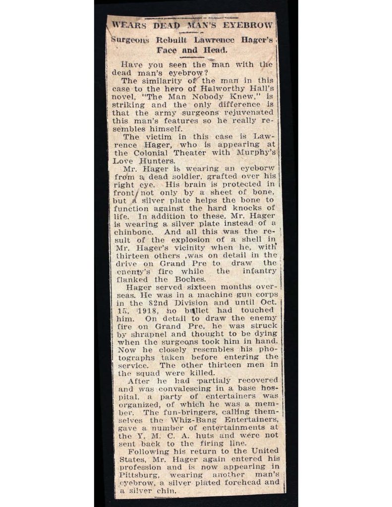 a newspaper clipping titled 'wears dead man's eyebrow' telling about the surgeon who rebuilt lawrence thomas hager's face and head